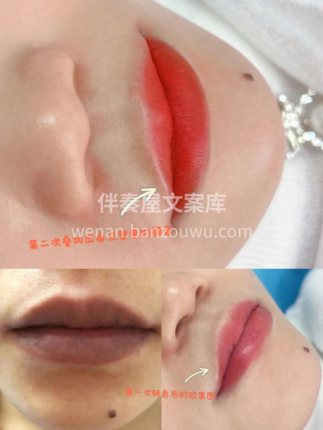 改乌唇✅ 转色➕调色 还你健康唇色