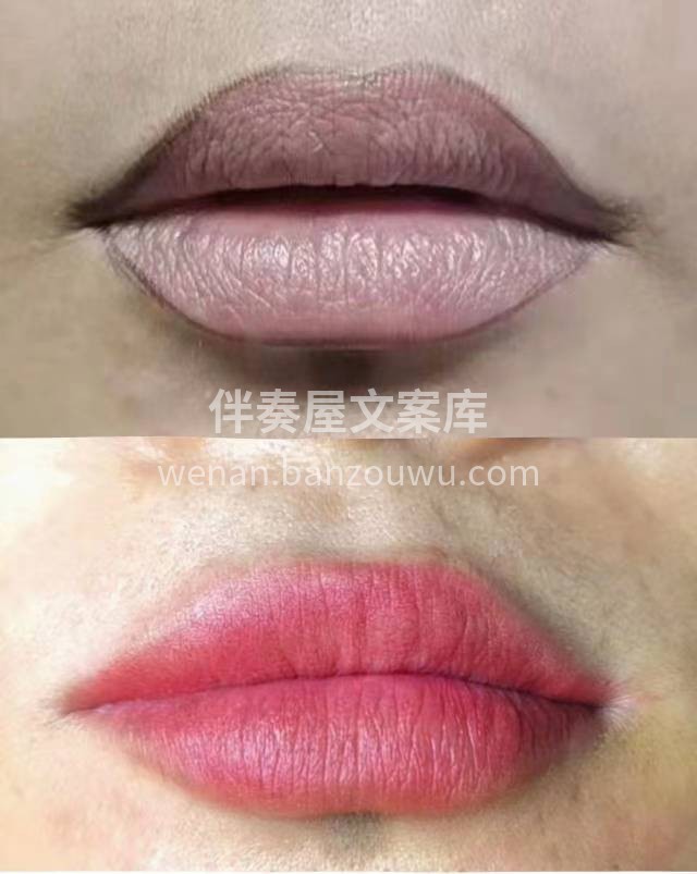 ▫️拯救乌唇 秒回少女 ▫️可以立即拥有