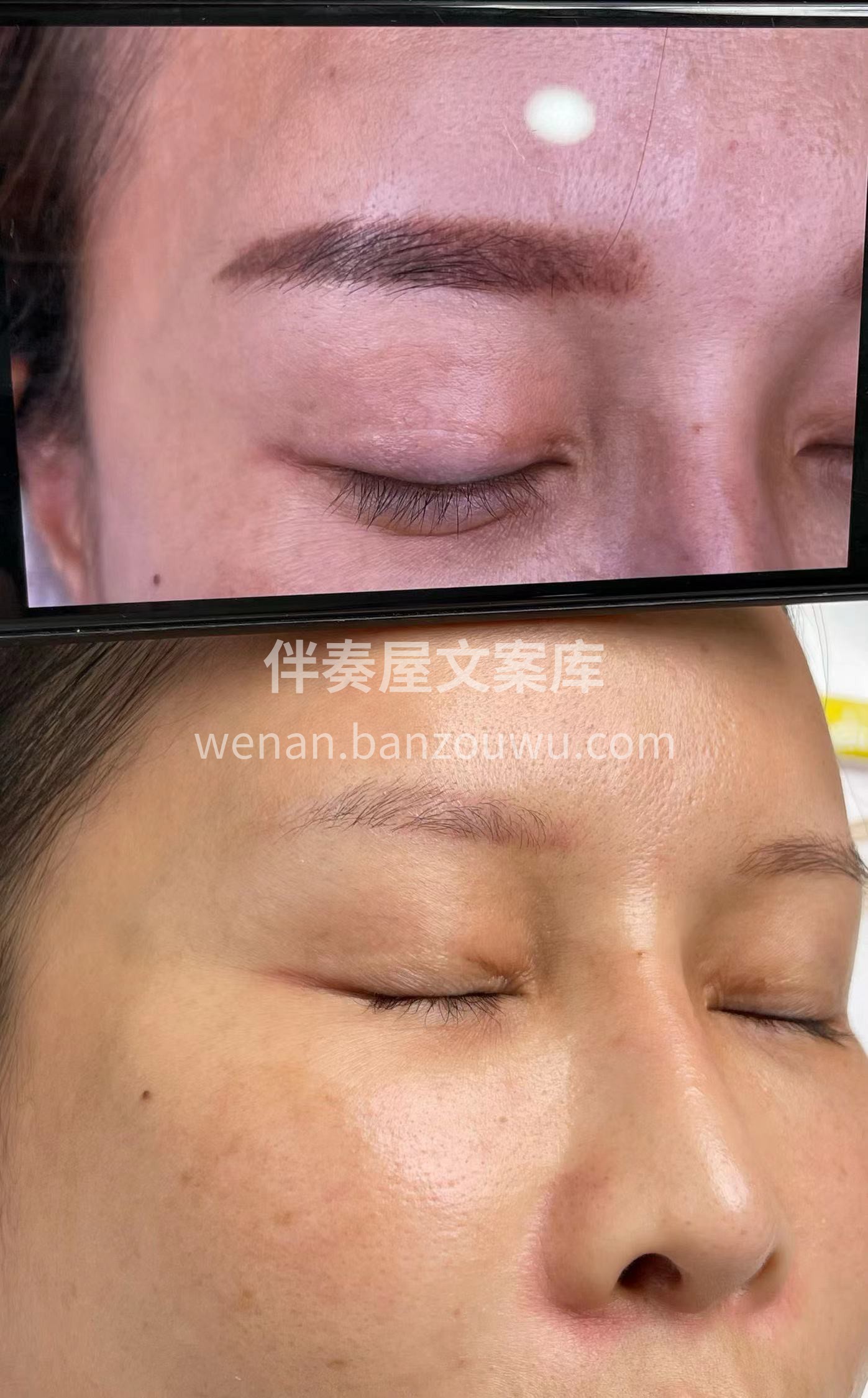 洗眉合集案例 配图6
