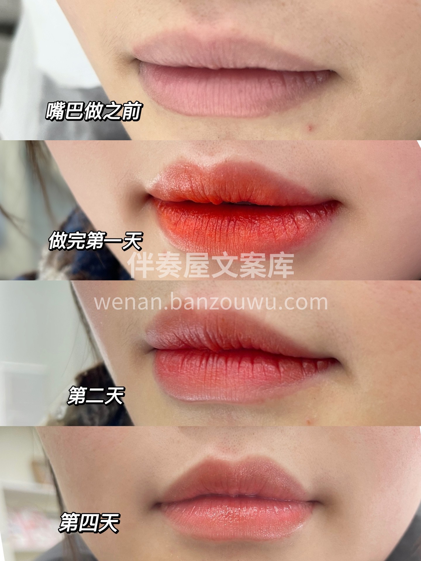 少女妈生唇👄 这样的唇色是你想拥有的吗 配图2