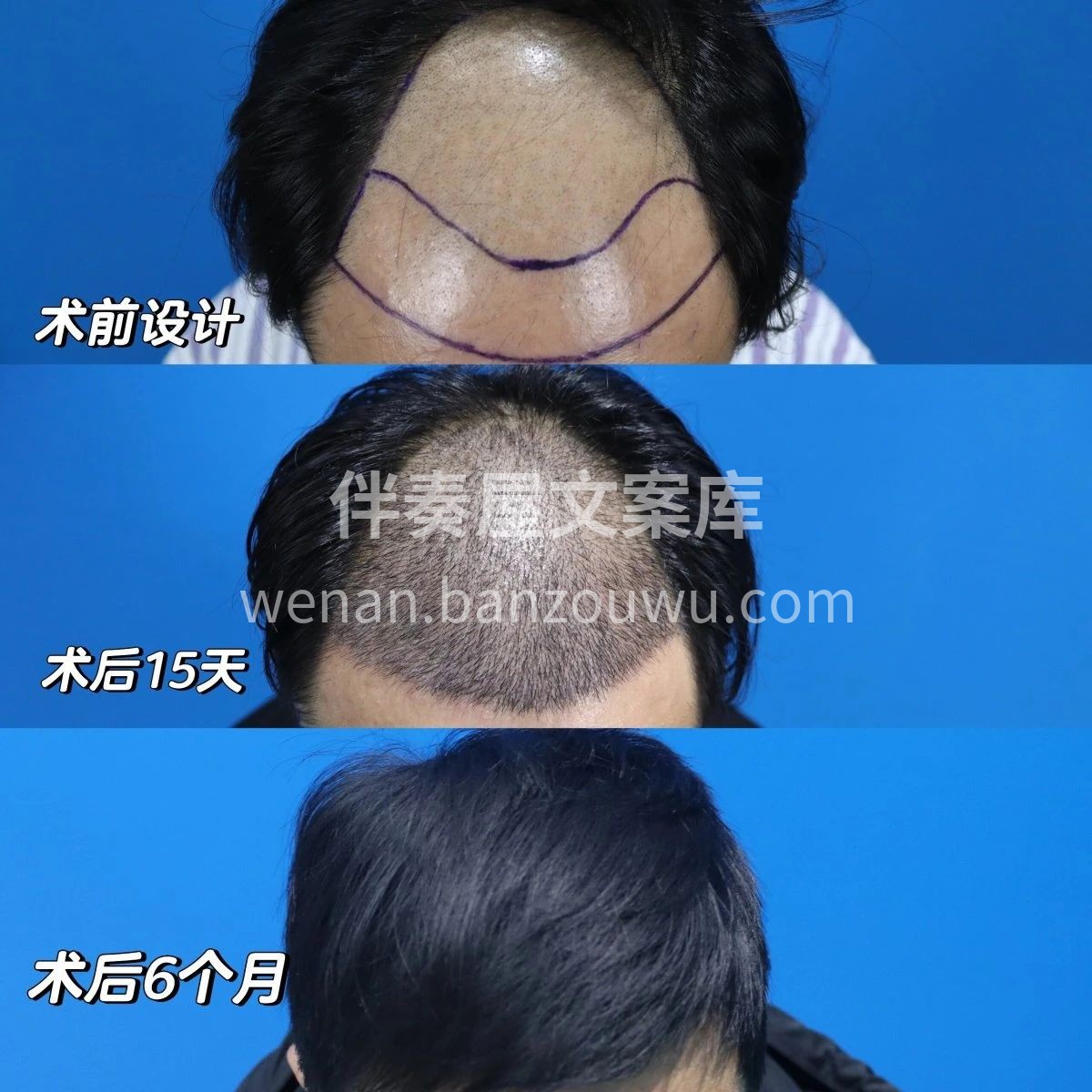 当你踏出这一步 改变的便不仅仅是头发 从