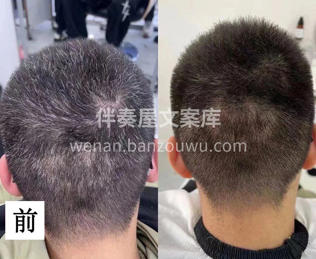 以前几根白发，拖着不调理 ❌ 很快就会爬