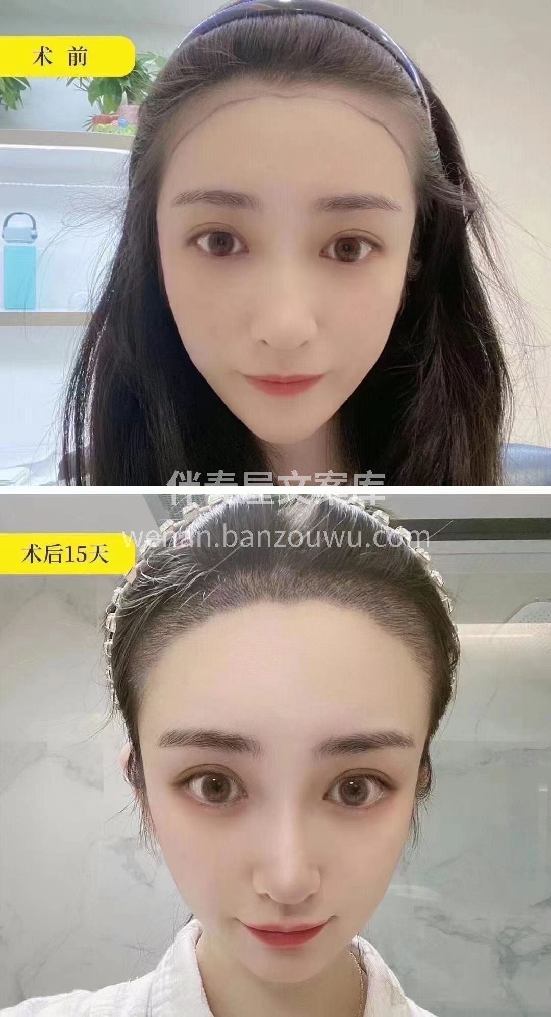 一白遮百丑 一秃毁所有🤦‍♀️ 小仙女🧚